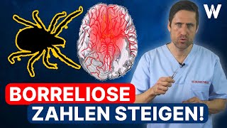 Zeckenalarm BorrelioseSymptome erkennen Die Gefahr der Neuroborreliose  BorrelioseBehandlung [upl. by Malanie]