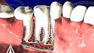 Tooth Anatomy  3D Medical Animation [upl. by Acherman]