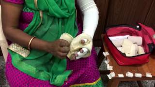 Self bandaging technique for arm Lymphedema [upl. by Sapphira]