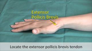 Musculoskeletal Examination and Joint Injection Series DeQuervains Tenosynovitis Injection [upl. by Conner]