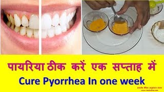 पायरिया ठीक करें एक सप्ताह में  Cure Pyorrhea In one week [upl. by Nylorak]