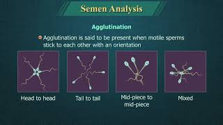 Semen Analysis [upl. by Los]