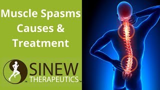 Muscle Spasms Causes and Treatment [upl. by Nalra]