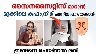 സൈനസൈറ്റിസ് പൂർണ്ണമായി മാറാൻ ഇങ്ങനെ ചെയ്താൽ മതി  Sinusitis Malayalam  Arogyam [upl. by Ahsatal]