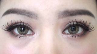 Full Incisional Double Eyelid Blepharoplasty  Epicanthoplasty 5 Months Update [upl. by Kaczer]