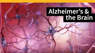 How Alzheimers Changes the Brain [upl. by Michele]