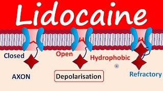 Lidocaine as Local Anesthetic [upl. by Doll]