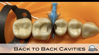 Back to Back Cavity Tutorial [upl. by Sila220]