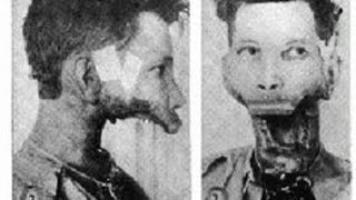 Top 10 Most Horrifying Human Experiments Ever [upl. by Ligetti]