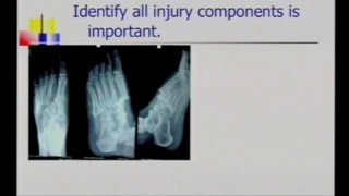 Lisfranc Inury [upl. by Consolata]