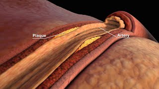 LDL and HDL Cholesterol  Good and Bad Cholesterol  Nucleus Health [upl. by Reivaj]