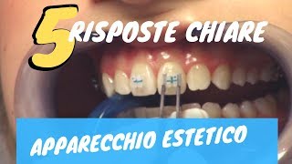 5 risposte CHIARE sullapparecchio ESTETICO [upl. by Ardnuas]