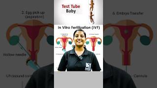 IVF or TEST TUBE BABY  जानिए कैसे TEST TUBE से होता है बच्चा [upl. by Bullock]