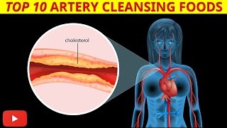 ►Top 10 Artery Cleansing Foods Clinically Proven  by Dr Sam Robbins [upl. by Zoes]