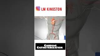 CARDIAC CATHETERIZATION in india [upl. by Klapp]