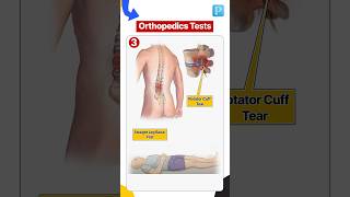 Essential Test For Orthopedics [upl. by Biegel144]