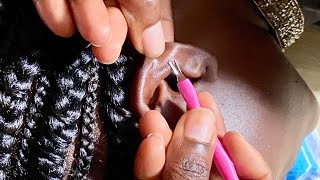 ASMR EAR CLEANING AND PICKING SO RELAXING WITH GUM CHEWING [upl. by Roscoe247]