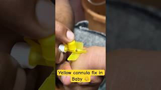 Yellow cannula fix in baby 👶  cannula cannulation trending shorts new SMpharmacy [upl. by Slocum]