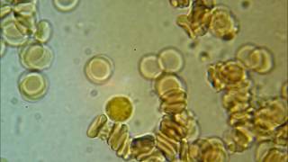 SPIROCHETES  coming out of a WBC [upl. by Pelletier]