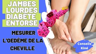 Suivi JAMBES LOURDES – DIABETE  ENTORSE Comment mesurer l’œdème de cheville [upl. by Anwaf315]