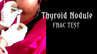 FNAC In The Diagnosis of Thyroid Nodule।। [upl. by Yecaw274]