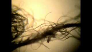 Morgellons Moving Fibers In The Environment Transhumanism Nano Fibers Getting Into Our Skin [upl. by Drawyeh]