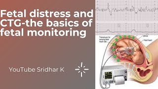 Monitoring for fetal distress CTG monitoring How do we decide action based on CTG Dr Sridhar K [upl. by Eerazed]