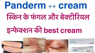 Panderm  cream uses in hindiclobetasol propionate neomycin sulphate amp miconazole nitrate cream [upl. by Ennaeirb]