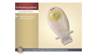 ColostomyIleostomy Pouching Systems [upl. by Ttsepmet721]