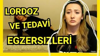 LORDOTİK POSTÜR  TEDAVİ EGZERSİZLERİ  LORDOZ [upl. by Htiek484]