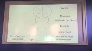 USMLE Tutorial  Localizing Neuroanatomical Lesions [upl. by Ifok446]