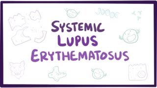 Systemic lupus erythematosus SLE  causes symptoms diagnosis amp pathology [upl. by Breech167]