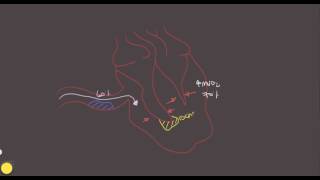 Stable Angina [upl. by Edette]