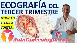 ECOGRAFÍA DEL TERCER TRIMESTRE TÉCNICA CORTE por CORTE UTILIDAD  Ginecología y Obstetricia [upl. by Immat831]