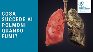 Come sono i polmoni di un fumatore Cosa succede ai tuoi polmoni quando fumi [upl. by Nomad]