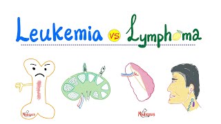 Leukemia amp Lymphoma Introduction  Distinctions in Oncology  Hematology Series [upl. by Natika]