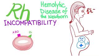 Rh incompatibility and Hemolytic disease of the newborn HDN [upl. by Akselav]