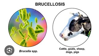 Mystery diagnosis Brucellosis [upl. by Quinn]