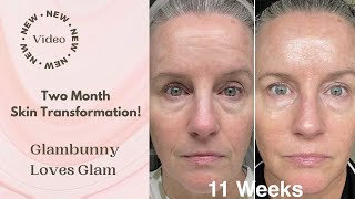 Two Months of Consistent Skincare Results [upl. by Mitch]