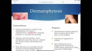 Superficial and Cutaneous Mycosis [upl. by Eelnayr]