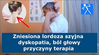 Spłycona zniesiona lordoza szyjna  Przepuklina szyjna  Dyskopatia  Objawy ćwiczenia 🇵🇱 🇪🇺 [upl. by Ellinet]