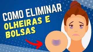 Como Se Livrar de OLHEIRAS BOLSAS NOS OLHOS e INCHAÇO [upl. by Rogerson576]