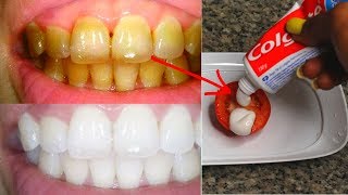 IN 2 MINUTES TURN YELLOW TEETH TO PEARLY WHITE WITH TOMATO [upl. by Blumenfeld780]