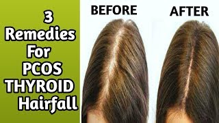 3 Home Remedies for hair fall hairfall due to PCOS pcod and thyroidRachna Reviews [upl. by Ellezaj]