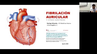 Fibrilación auricular y otras arritmias  Escuela de Verano 2023 [upl. by Socha]