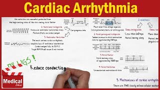 Pharmacology CVS 13 Cardiac Arrhythmia Mechanisms and Types MADE EASY [upl. by Nosnhoj373]