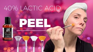 40 LACTIC ACID PEEL  FOR GLOWING HOLIDAY SKIN [upl. by Tolman]