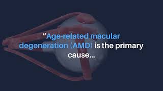 AgingUS  Agerelated Macular Degeneration and Creactive Protein [upl. by Nneb]