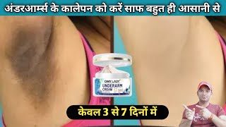 Omy lady underarms cream use benefits side effects full reviewअंडरआर्म्स के कालेपन को कैसे दूर करें [upl. by Murdocca]