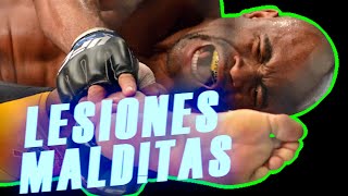 😱TERRIBLES LESIONES en UFC las PEORES LESIONES de peleadores de UFC [upl. by Ahcilef333]